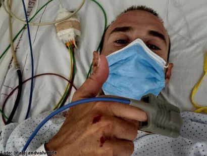 Sin acuerdo en el caso del intento de homicidio del exciclista Alejandro Valverde