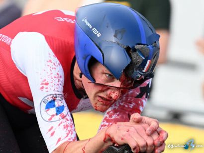 Campeonato de Europa: Stefan Küng, con conmoción cerebral y fracturas tras el accidente