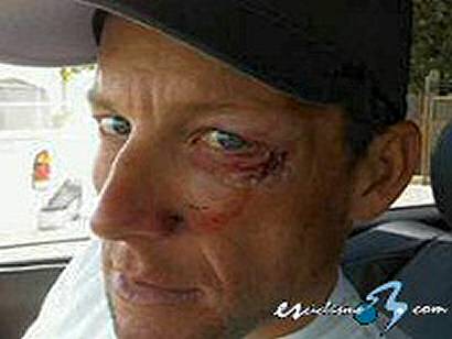 Lance Armstrong abandona el Tour de California tras una caída